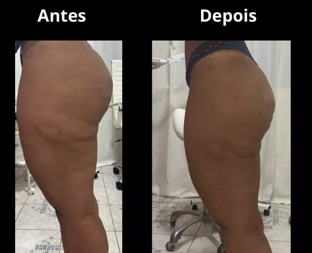 Depoimento de cliente 5